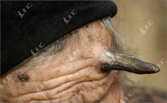 Рог 100-летней женщины